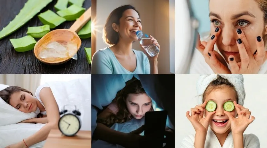 Natural remedies to treat dark circles at home permanently