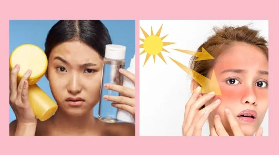 Skincare Mistakes